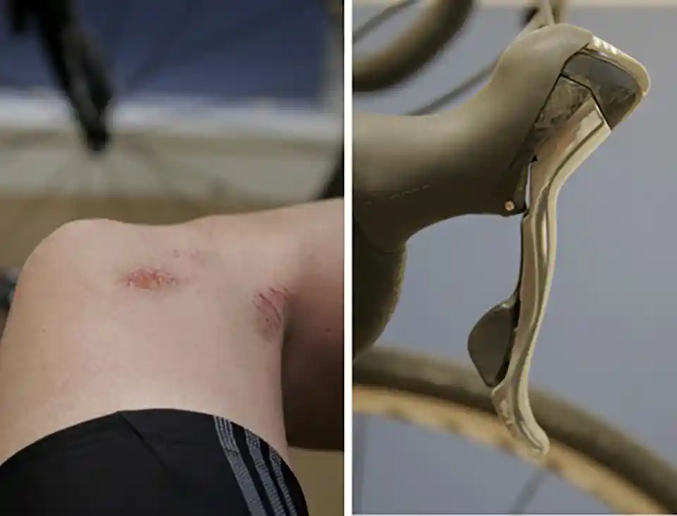 立ちゴケの傷跡1、2